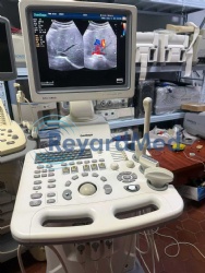 Used Like New SonoScape SSI-5500 Ultrasound Machine