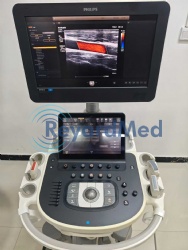 Used Like New Philips EPIQ 5 Ultrasound Machine
