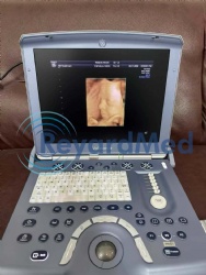 Used Like New GE Voluson e Ultrasound Machine
