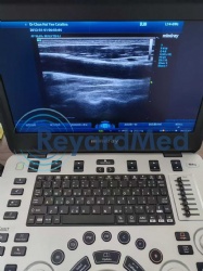 Used Like New Mindray M9 Ultrasound Machine